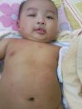 binhmp